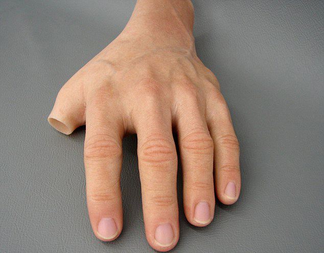 安裝一個(gè)左手假肢價(jià)格多少錢(qián)(圖1)